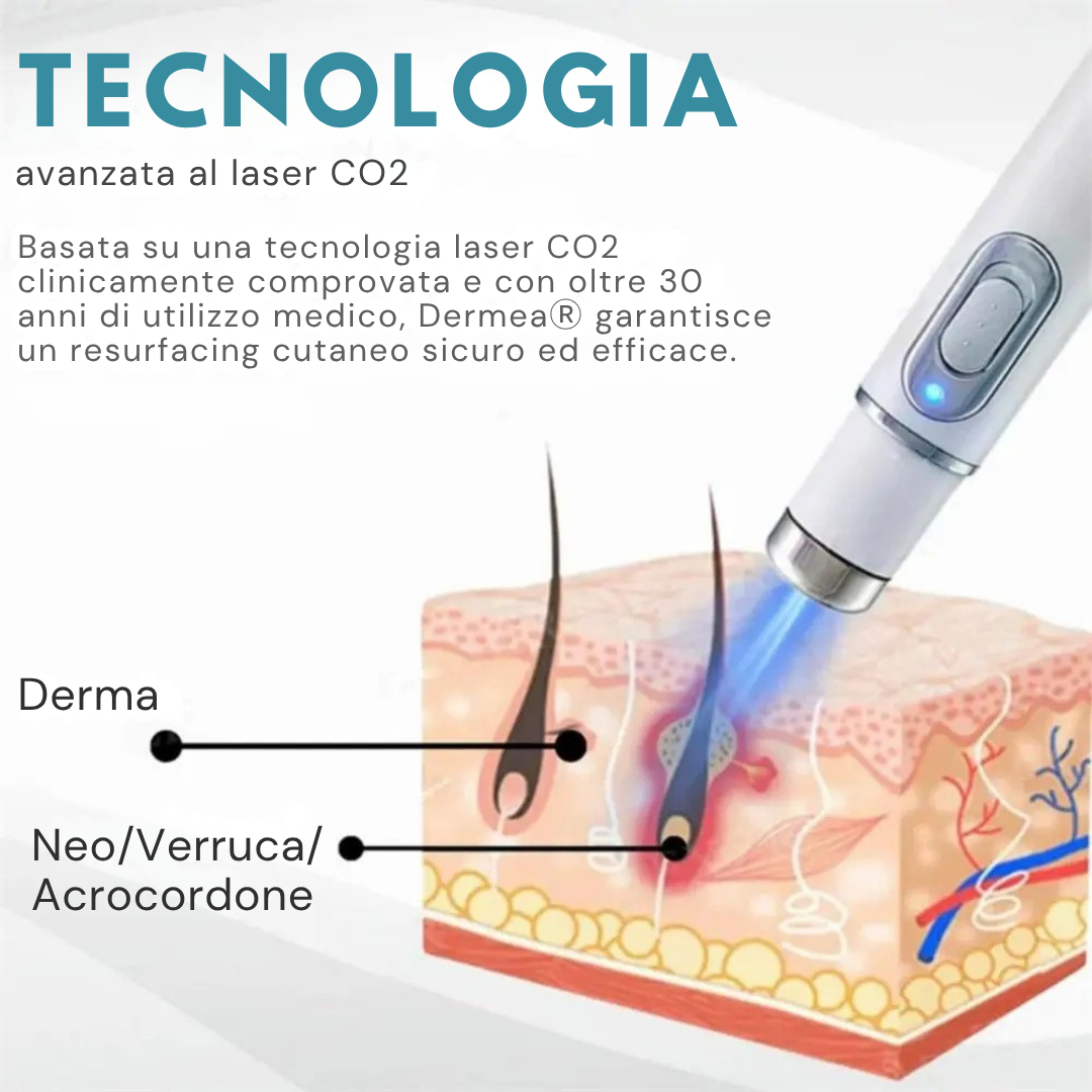 Lápiz láser Derma™ para manchas cutáneas y verrugas